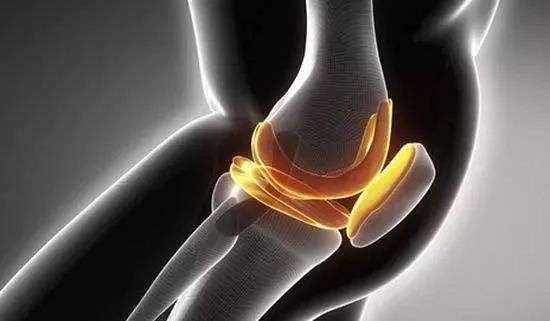 科普 | 膝關(guān)節(jié)積液，到底能不能抽？