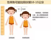 孩子長(zhǎng)不高、性早熟，免費(fèi)測(cè)骨齡來啦！骨齡儀免費(fèi)檢測(cè)義診！