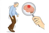 數(shù)九寒天，如何預(yù)防卒中發(fā)生？要牢記這5點……