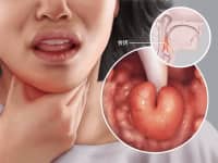 日常生活中，常見耳鼻喉三大致命急癥，不要忽視！