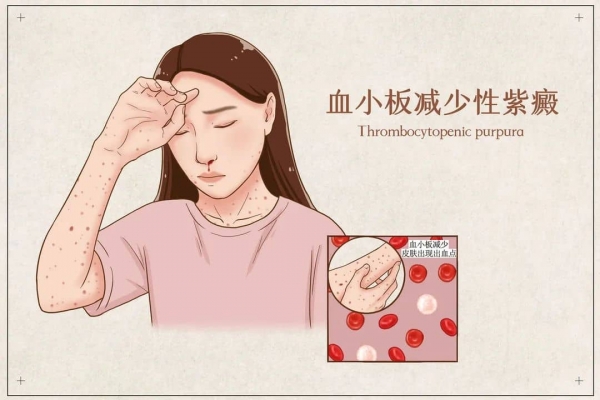 攝圖網(wǎng)_401868048_banner_血小板減少性紫癜醫(yī)療插畫(企業(yè)商用).jpg 5-tuya.jpg