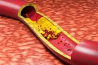 血管堵不堵走一走就能知道！出現(xiàn)這6個(gè)信號(hào)就要當(dāng)心！