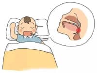9歲男孩睡覺(jué)打鼾，醫(yī)生：嚴(yán)重會(huì)影響智力發(fā)育！