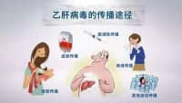 這種肝炎會傳染，治療沒選對會發(fā)展成肝癌！
